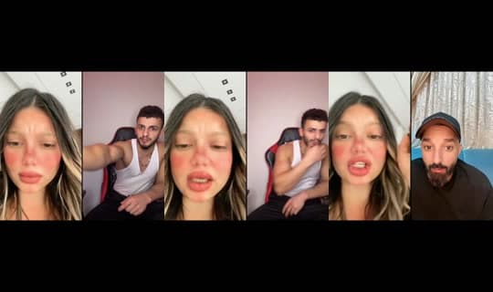 amyahmeed Yayını - 4 Mar 2026 1:39